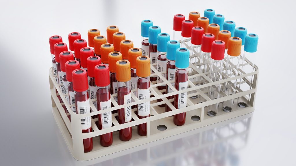 blood collection, blood analysis, laboratory-6574436.jpg